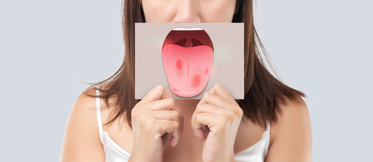 oral cancer screening