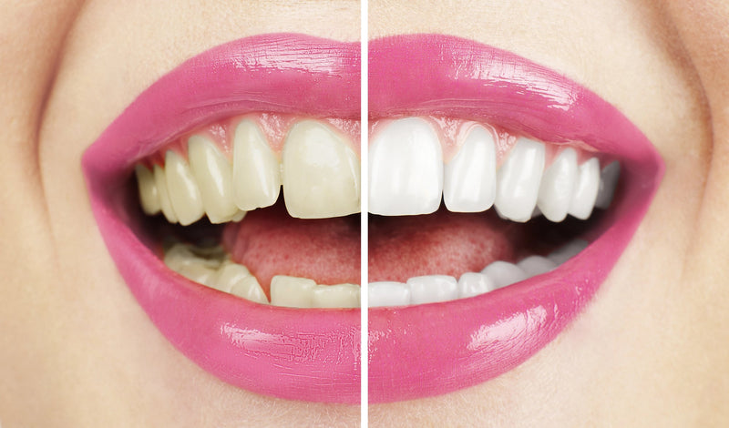 sensitive teeth