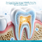 CrystLCare™ Biorestorative Dental Strips with Nano Hydroxyapatite for Enamel Strengthening